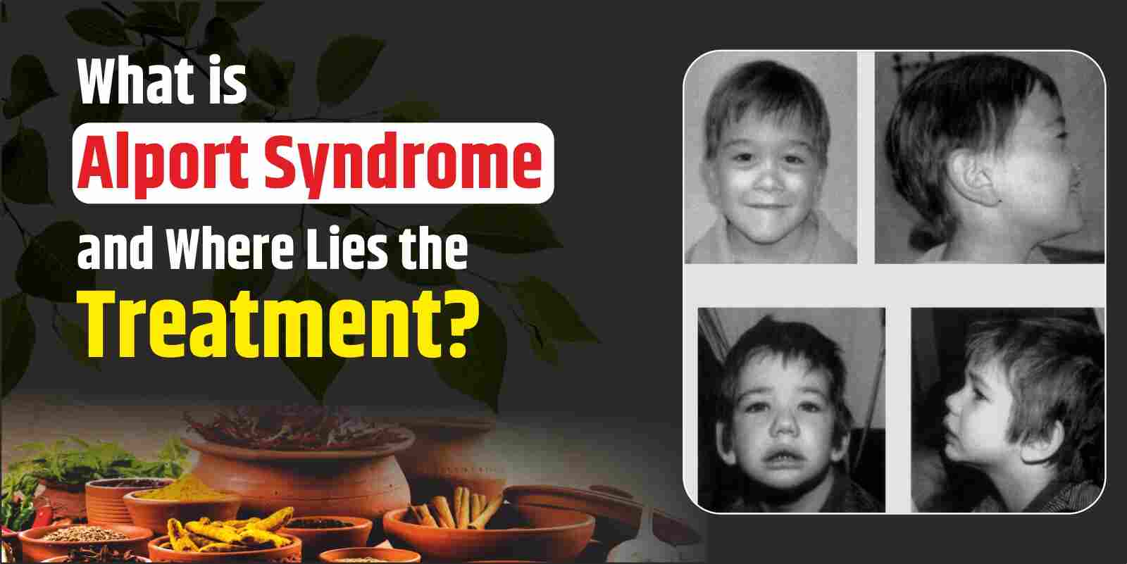 Alport syndrome treatment in Ayurveda